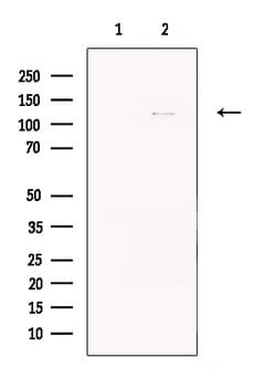 ZEB1 Polyclonal Antibody:Antibodies, Polyclonal