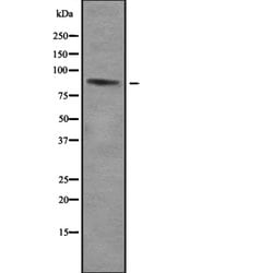 Invitrogen ZNF785 Polyclonal Antibody 100 &mu;L | Buy Online | Invitrogen&trade; | Fisher Scientific