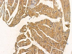 Invitrogen PHOSPHO1 Polyclonal Antibody 100 &mu;L; Unconjugated:Antibodies,