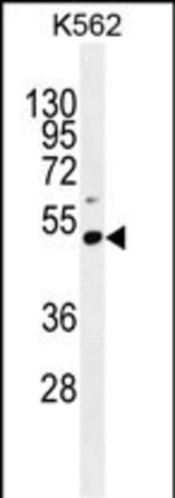 Invitrogen PRAMEF10 Polyclonal Antibody 400 &mu;L | Buy Online | Invitrogen&trade; | Fisher Scientific