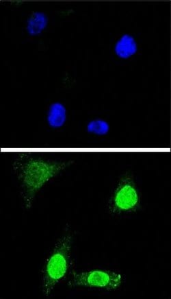 Invitrogen WDR70 Polyclonal Antibody 400 &mu;L; Unconjugated:Antibodies,