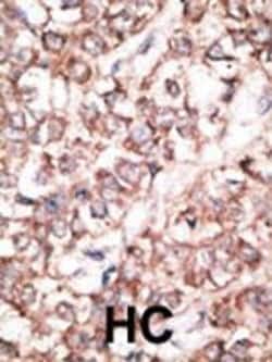 Invitrogen DKK2 Polyclonal Antibody 400 &mu;L; Unconjugated:Antibodies,