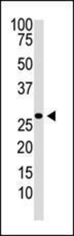 Invitrogen DKK2 Polyclonal Antibody 400 &mu;L; Unconjugated:Antibodies,