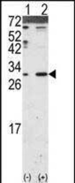 Invitrogen DKK2 Polyclonal Antibody 400 &mu;L; Unconjugated:Antibodies,