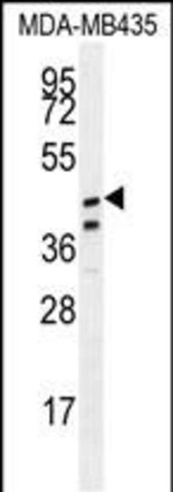 Invitrogen&trade;&nbsp;SAMD7 Polyclonal Antibody