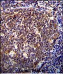 Invitrogen HOXB6 Polyclonal Antibody 400 &mu;L | Buy Online | Invitrogen&trade; | Fisher Scientific