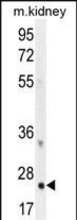 Invitrogen HOXB6 Polyclonal Antibody 400 &mu;L | Buy Online | Invitrogen&trade; | Fisher Scientific
