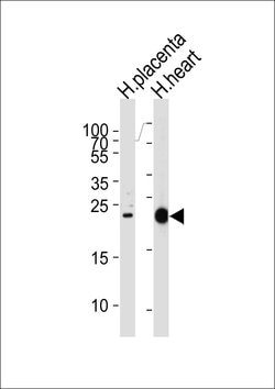Invitrogen FRAT2 Polyclonal Antibody 400 &mu;L; Unconjugated:Antibodies,