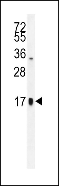 Invitrogen CGA Polyclonal Antibody 400 μL; Unconjugated:Antibodies,