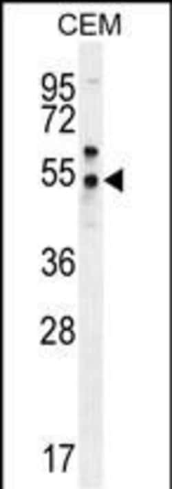 Invitrogen PSMAL Polyclonal Antibody 400 &mu;L; Unconjugated:Antibodies,