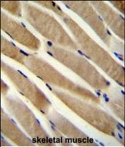 Invitrogen RNF90 Polyclonal Antibody 400 &mu;L | Buy Online | Invitrogen&trade; | Fisher Scientific