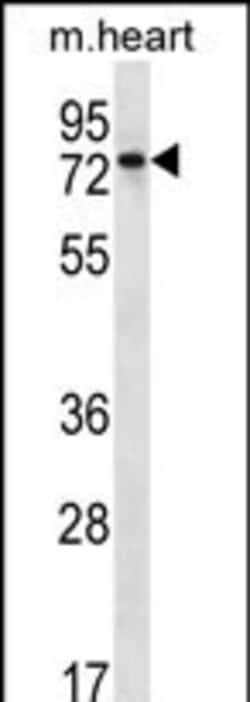 Invitrogen PARP2 Polyclonal Antibody 400 &mu;L; Unconjugated:Antibodies,