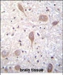 Invitrogen SPON1 Polyclonal Antibody 400 &mu;L; Unconjugated:Antibodies,