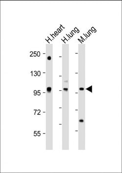 Invitrogen SPON1 Polyclonal Antibody 400 &mu;L; Unconjugated:Antibodies,