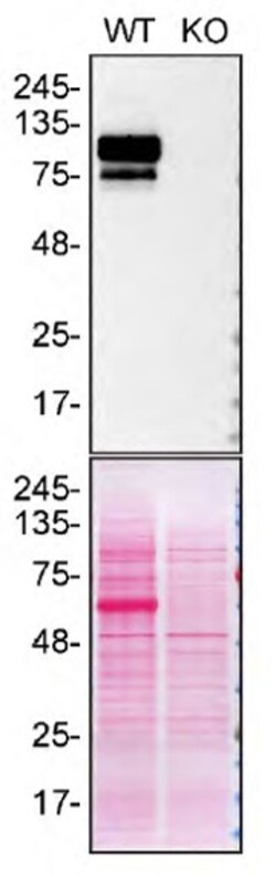 Invitrogen SPON1 Polyclonal Antibody 400 &mu;L; Unconjugated:Antibodies,