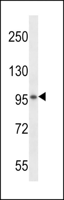 Invitrogen SPON1 Polyclonal Antibody 400 &mu;L; Unconjugated:Antibodies,