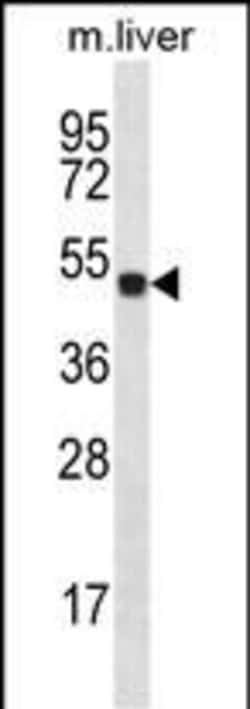 Invitrogen HOXD10 Polyclonal Antibody 400 &mu;L; Unconjugated:Antibodies,