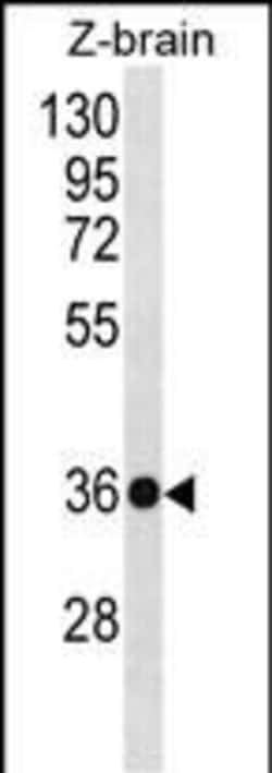 Invitrogen HOXD10 Polyclonal Antibody 400 &mu;L; Unconjugated:Antibodies,