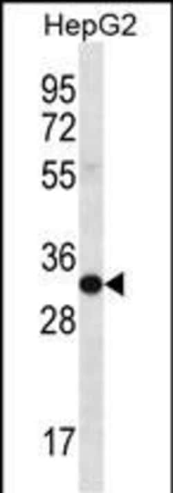 Invitrogen SULT1A3/SULT1A4 Polyclonal Antibody 400 &mu;L; Unconjugated:Antikörper