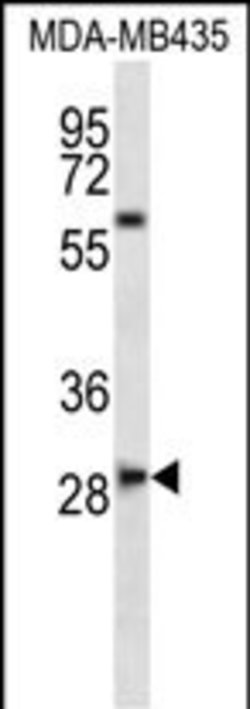 Invitrogen SLAMF8 Polyclonal Antibody 400 &mu;L | Buy Online | Invitrogen&trade; | Fisher Scientific
