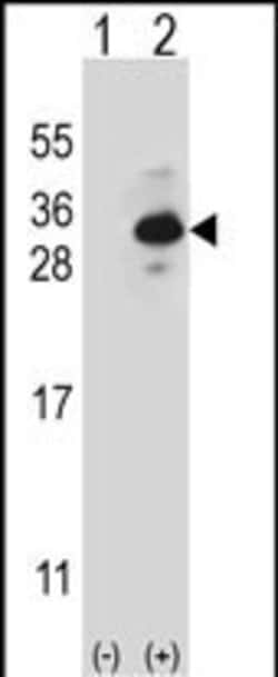 CLTB Polyclonal Antibody 400 &mu;L | Buy Online | Thermo Fisher Scientific | Fisher Scientific