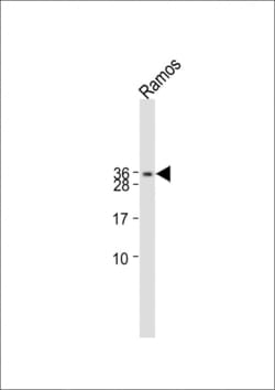 Invitrogen hCG beta Polyclonal Antibody 200 &mu;L; Unconjugated:Antibodies,