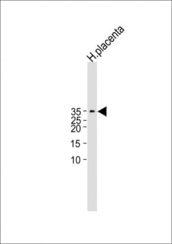 Invitrogen hCG beta Polyclonal Antibody 200 &mu;L; Unconjugated:Antibodies,