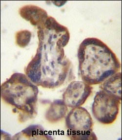 Invitrogen hCG beta Polyclonal Antibody 200 &mu;L; Unconjugated:Antibodies,