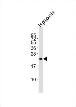 Invitrogen hCG beta Polyclonal Antibody 200 &mu;L; Unconjugated:Antibodies,