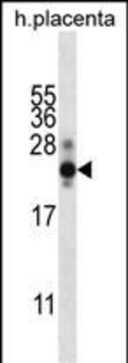 Invitrogen hCG beta Polyclonal Antibody 200 &mu;L; Unconjugated:Antibodies,