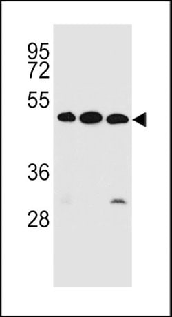 Invitrogen KREMEN2 Polyclonal Antibody 400 &mu;L; Unconjugated:Antibodies,