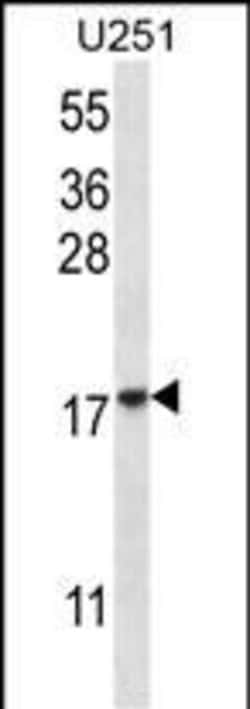 eIF1AY Polyclonal Antibody:Antibodies, Polyclonal