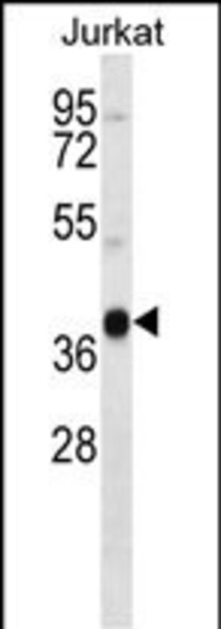 Invitrogen MARCH4 Polyclonal Antibody 400 &mu;L; Unconjugated:Antibodies,