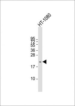 Invitrogen NY-ESO-1 Polyclonal Antibody 400 &mu;L; Unconjugated:Antibodies,