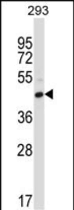 CD32 Polyclonal Antibody:Antibodies, Polyclonal