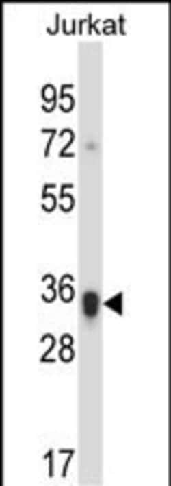 Invitrogen KIR2D Polyclonal Antibody 400 &mu;L; Unconjugated:Antibodies,