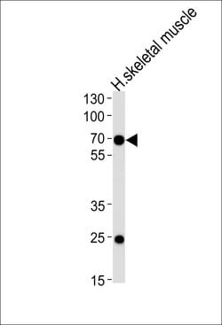 Invitrogen FAM198B Polyclonal Antibody 400 &mu;L; Unconjugated:Antibodies,