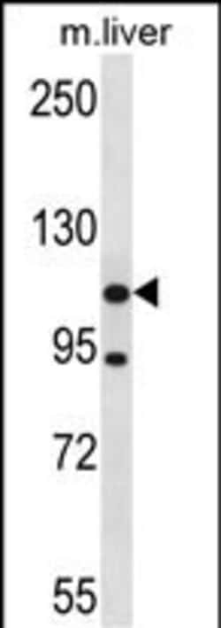 Invitrogen ADNP2 Polyclonal Antibody 400 &mu;L | Buy Online | Invitrogen&trade; | Fisher Scientific