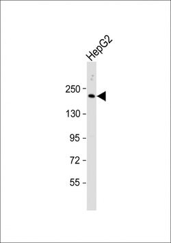 Complement C4 Polyclonal Antibody:Antibodies, Polyclonal