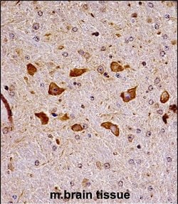 Invitrogen PAK7 Polyclonal Antibody 400 μL; Unconjugated:Antibodies,