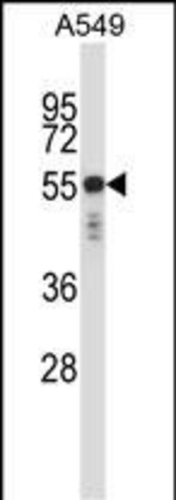 Invitrogen Cytokeratin 6 Polyclonal Antibody 400 &mu;L; Unconjugated:Antibodies,