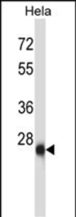 Invitrogen ZIC4 Polyclonal Antibody 400 &mu;L | Buy Online | Invitrogen&trade; | Fisher Scientific