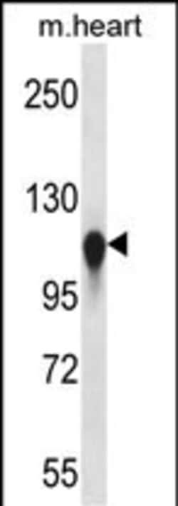 Invitrogen Kinesin 5C Polyclonal Antibody 400 &mu;L; Unconjugated:Antibodies,