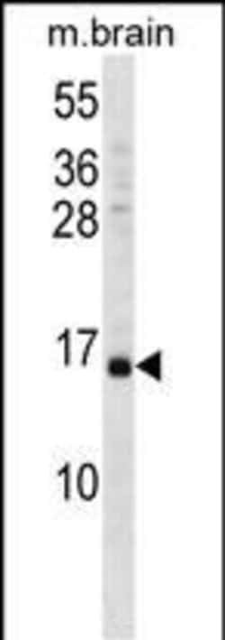 Invitrogen VAMP3 Polyclonal Antibody 400 &mu;L; Unconjugated:Antibodies,