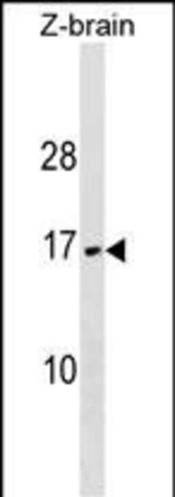 Invitrogen VAMP3 Polyclonal Antibody 400 &mu;L; Unconjugated:Antibodies,