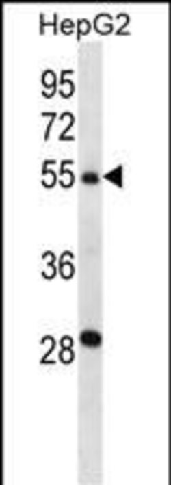 Invitrogen TMPRSS13 Polyclonal Antibody 400 &mu;L; Unconjugated:Antibodies,