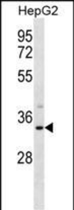 Invitrogen SULT1A3 Polyclonal Antibody 400 &mu;L; Unconjugated:Antibodies,
