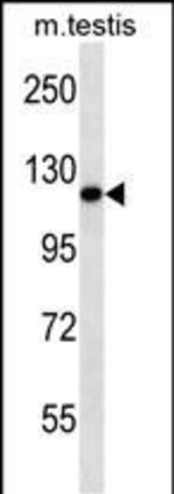 ERN2 Polyclonal Antibody:Antibodies, Polyclonal