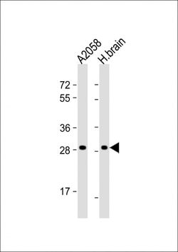 OR4F17 Polyclonal Antibody, Invitrogen 400 &mu;L; Unconjugated:Antibodies,