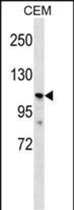 Invitrogen PK2L1 Polyclonal Antibody 400 &mu;L; Unconjugated:Antibodies,